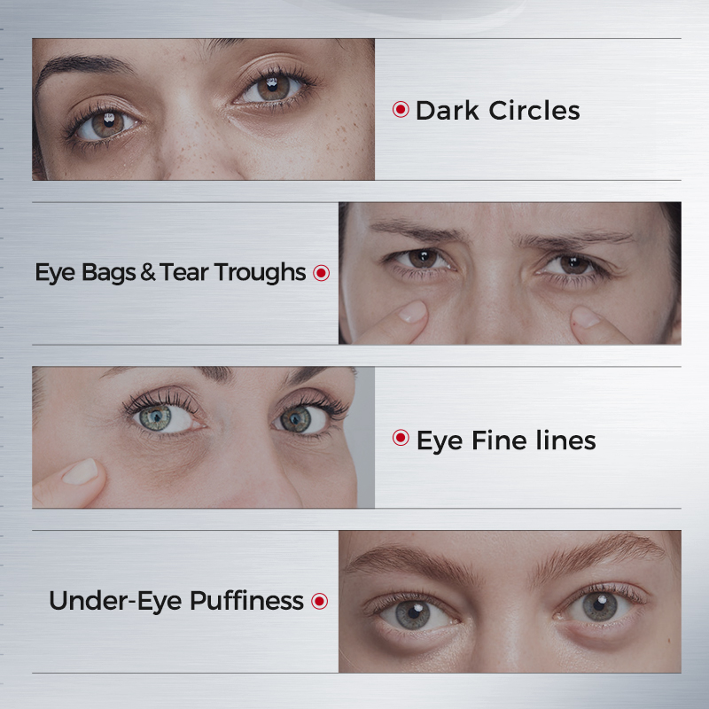 Patch per Occhi Contro Occhiai - Eye Pad Collagen recensione e prezzo