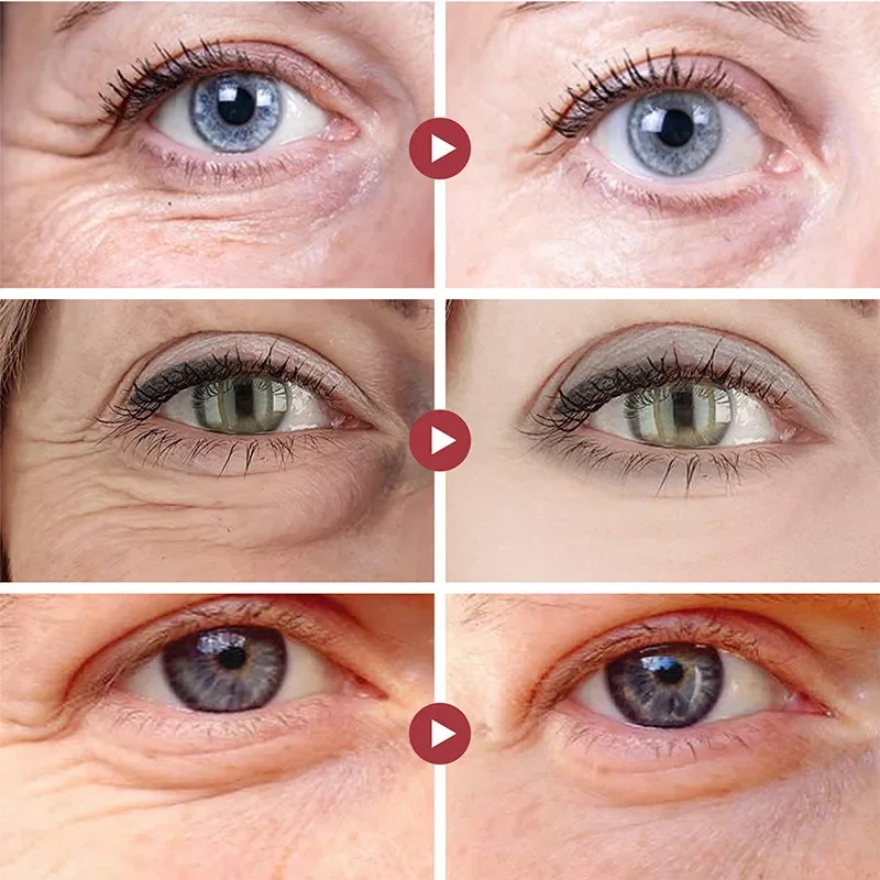 Rughe Rimuovere Gli Occhi Patc - Eye Pad Collagen recensione e prezzo